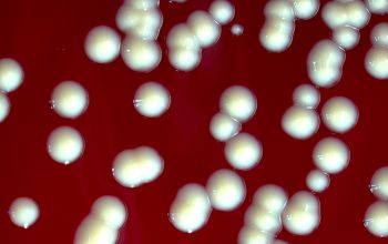 Kocuria kristinae (Rothia kristinae) Blood Agar 48h culture incubated with O2