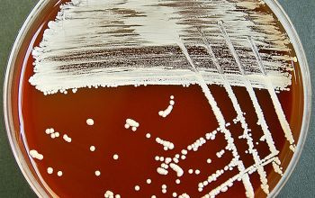 Kocuria kristinae (Rothia kristinae) Blood Agar 48h culture incubated with O2