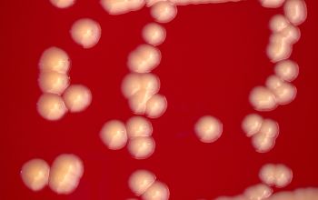 Kocuria kristinae (Rothia kristinae) Blood Agar 48h culture incubated with O2