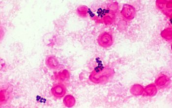 Kocuria kristinae (Rothia kristinae) Gram stain