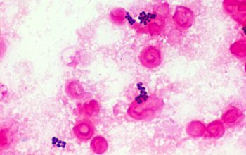 Kocuria kristinae Gram stain