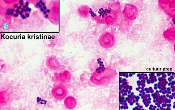 Kocuria kristinae (Rothia kristinae) Gram stain