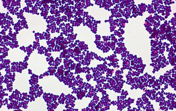 Kocuria kristinae (Rothia kristinae) Gram stain