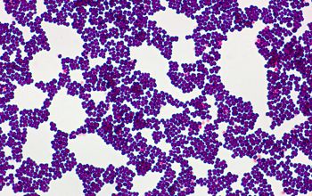 Kocuria kristinae Gram stain