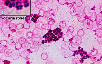 Kocuria rosea Gram stain