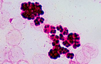 Kocuria rosea Gram stain