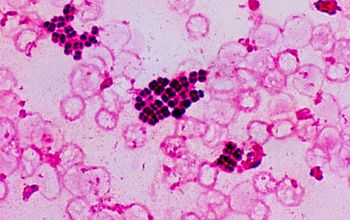 Kocuria rosea Gram stain