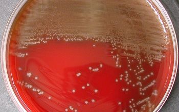 Lactobacillus acidophilus Blood Agar 48h culture incubated with CO2