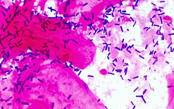Lactobacillus acidophilus Gram stain