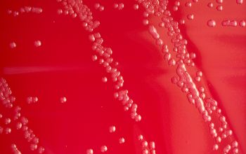 Lactobacillus casei Blood Agar 24h culture incubated with CO2