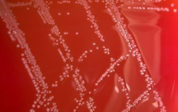 Lactobacillus casei Blood Agar 48h culture incubated with CO2