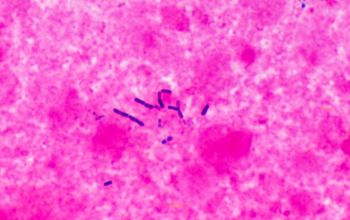 Lactobacillus casei Gram stain