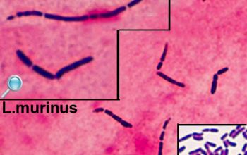 Lactobacillus murinus (Ligilactobacillus murinus) Gram stain