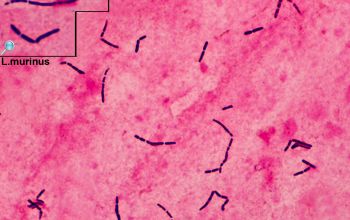 Lactobacillus murinus Gram stain