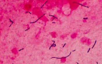Lactobacillus murinus (Ligilactobacillus murinus) Gram stain