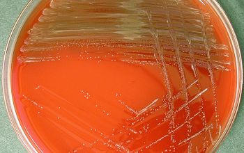 Lactobacillus rhamnosus (Lactocaseibacillus rhamnosum) Blood Agar 24h culture incubated with CO2
