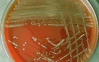 Lactobacillus rhamnosus (Lactocaseibacillus rhamnosum) Blood Agar 48h culture incubated with CO2