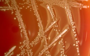 Lactobacillus rhamnosus (Lactocaseibacillus rhamnosum) Blood Agar 48h culture incubated with CO2