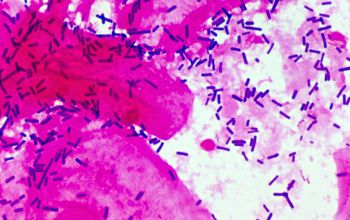 Lactobacillus rhamnosus Gram stain