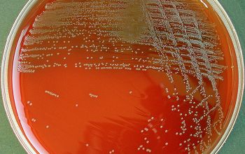Lactobacillus salivarius (Ligilactobacillus salivarius) Blood Agar 24h culture incubated with CO2