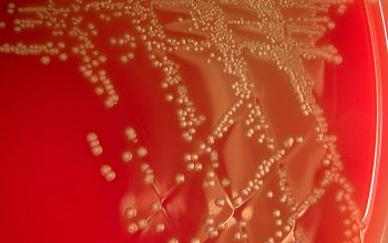 Lactobacillus salivarius (Ligilactobacillus salivarius) Blood Agar 24h culture incubated with CO2