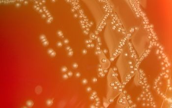 Lactobacillus salivarius (Ligilactobacillus salivarius) Blood Agar 48h culture incubated with CO2