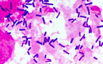 Lactobacillus salivarius (Ligilactobacillus salivarius) Gram stain