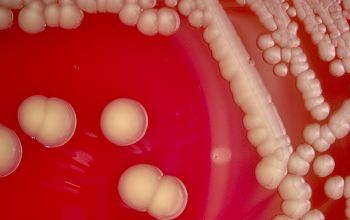 Leclercia adecarboxylata Blood Agar 48h culture incubated with O2