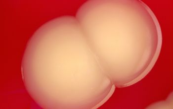 Leclercia adecarboxylata Blood Agar 48h culture incubated with O2