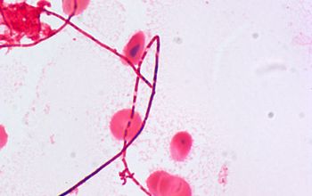 Leptotrichia buccalis Gram stain