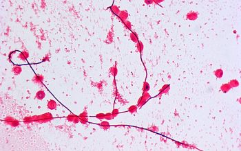 Leptotrichia buccalis Gram stain