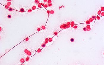 Leptotrichia buccalis Gram stain