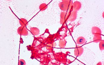 Leptotrichia buccalis Gram stain