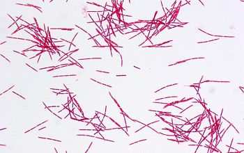 Leptotrichia buccalis Gram stain