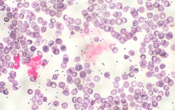 Leuconostoc lactis Gram stain