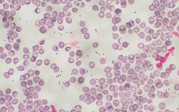 Leuconostoc lactis Gram stain