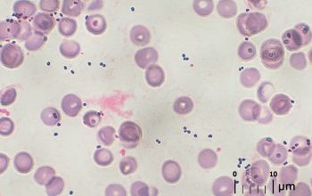 Leuconostoc lactis Gram stain