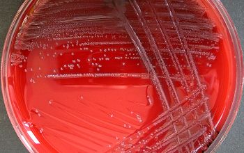 Listeria ivanovii Blood Agar 24h culture incubated with CO2