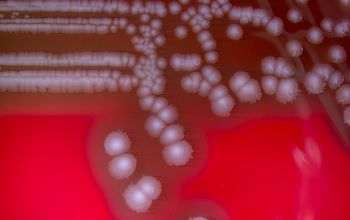 Listeria ivanovii Blood Agar 48h culture incubated with CO2