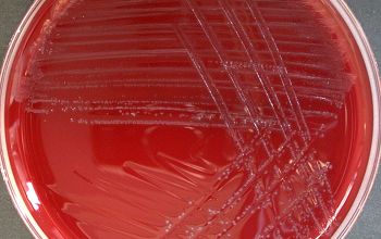 Listeria ivanovii Brucella Blood Agar 48h culture anaerobicly incubated