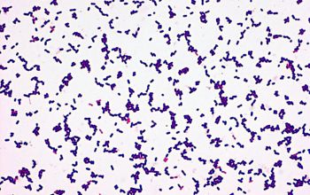 Listeria ivanovii Gram stain