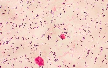 Listeria monocytogenes Gram stain