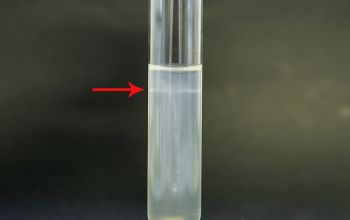 Listeria monocytogenes  culture 