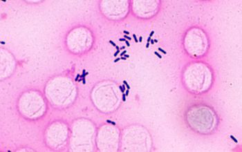 Listeria monocytogenes Gram stain