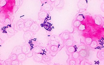 Listeria monocytogenes Gram stain