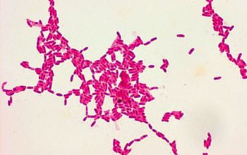 Methylobacterium rhodinum Gram stain