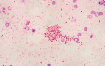 Methylobacterium species Gram stain