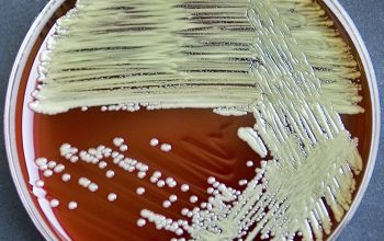 Microbacterium oxydans Blood Agar 48h culture incubated with O2