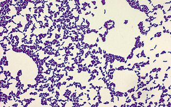 Microbacterium oxydans Gram stain