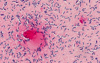 Microbacterium oxydans Gram stain